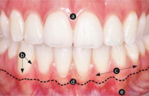 Prophylaxe / Dentalhygiene 69